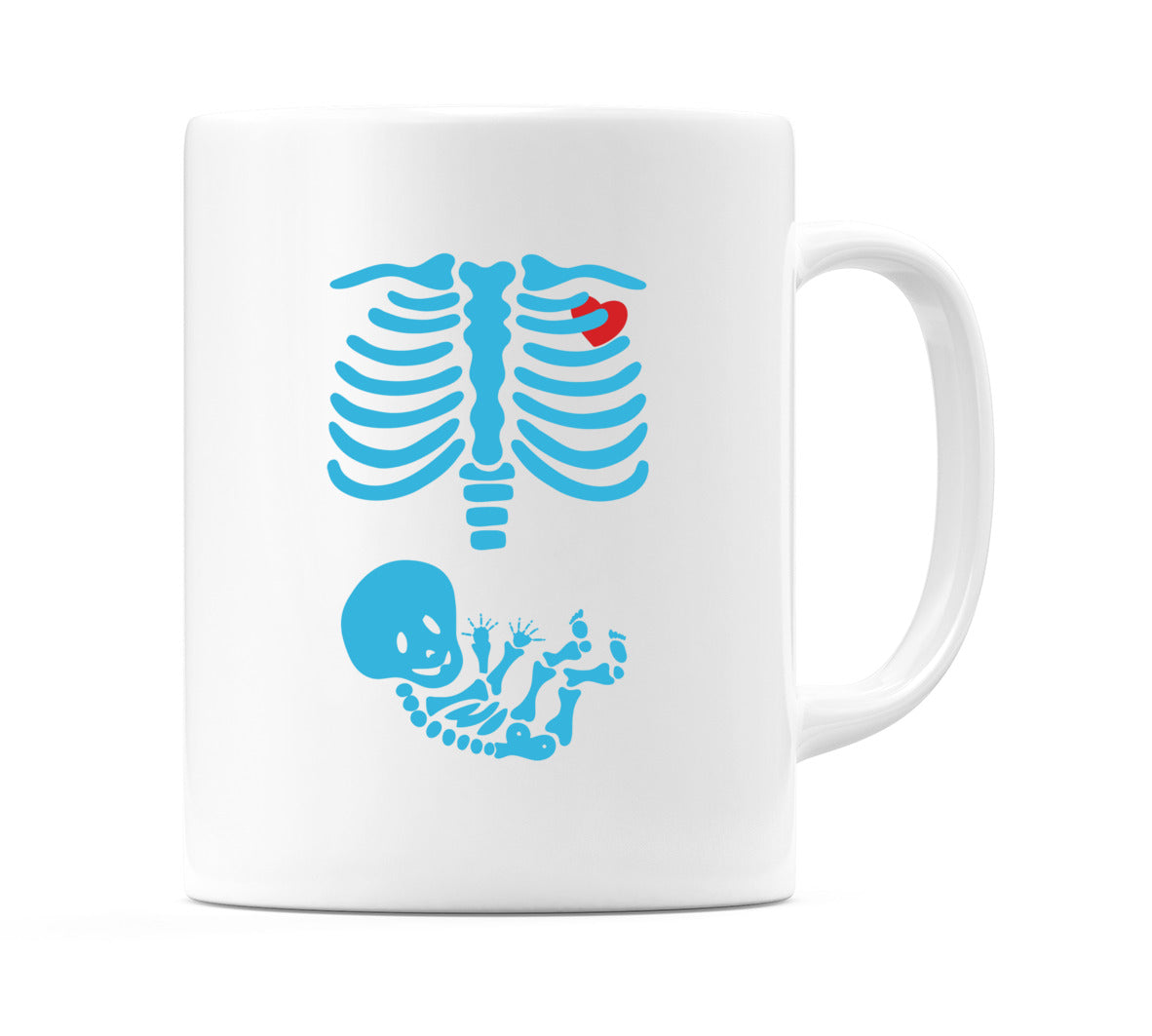 Radiografie Mug